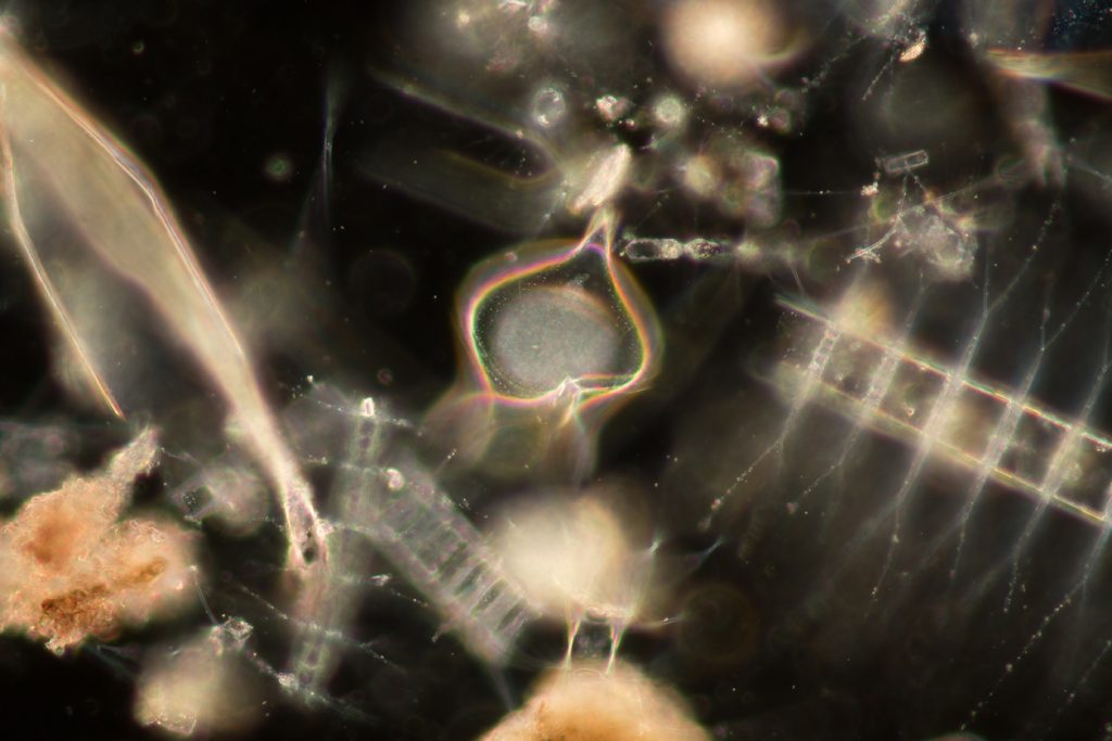 Chaetoceros (Diatom) under microscope
